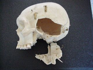 GENUINE ARTICULATED DISSECTED HUMAN SKULL FOR MEDICAL STUDY