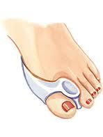   in 1 Bunion Corrector & Toe Straighteners Toe Gel Pain Relief (Pair